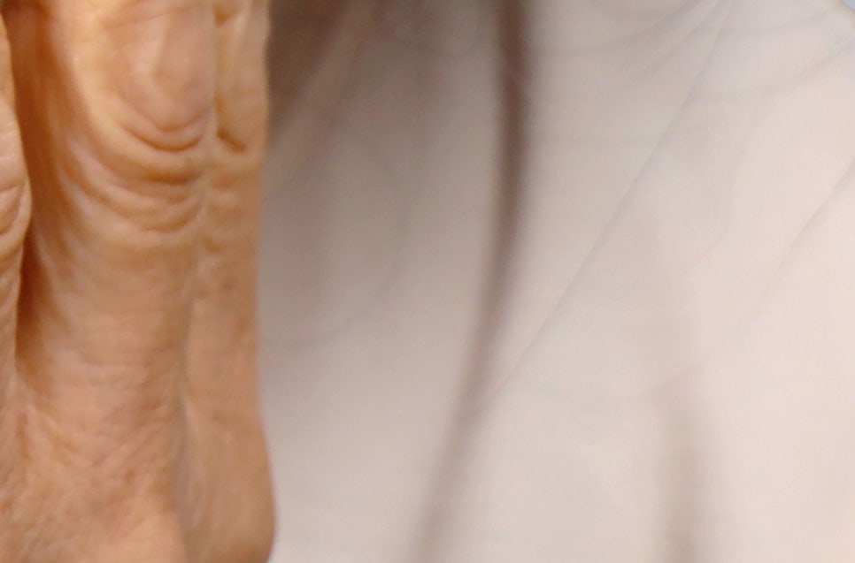 강남 어금니 임플란트 고려가 필요한 4가지! 관련 이미지 26