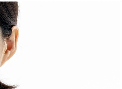 압구정로데오 임플란트 탄탄한 치아 유지는? 관련 이미지 20