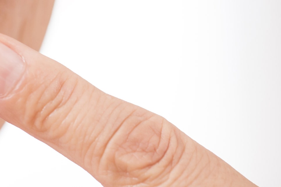 강남 65세이상임플란트 이것만 참고하자! 관련 이미지 14