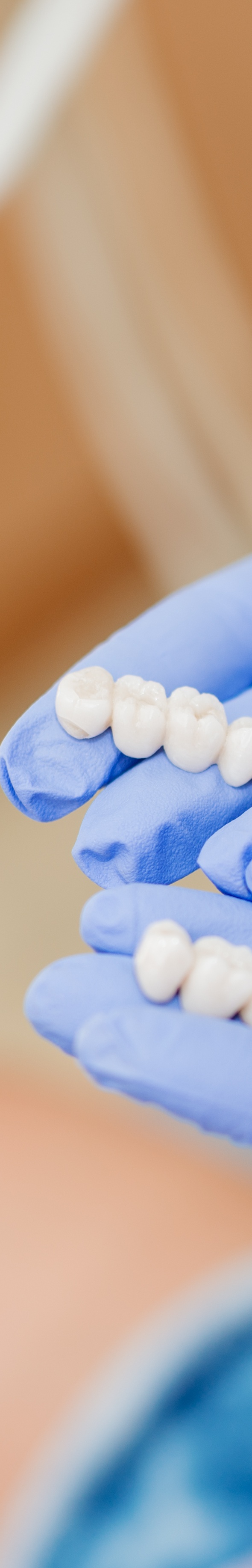 압구정역치과추천 이곳을 선택해도 괜찮을까 관련 이미지 22