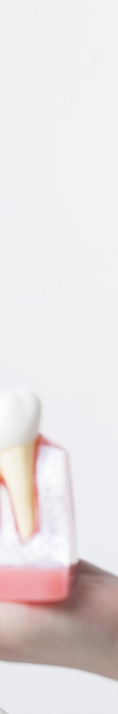 네비게이션임플란트가격 부담을 덜 수 있는 방법 관련 이미지 27