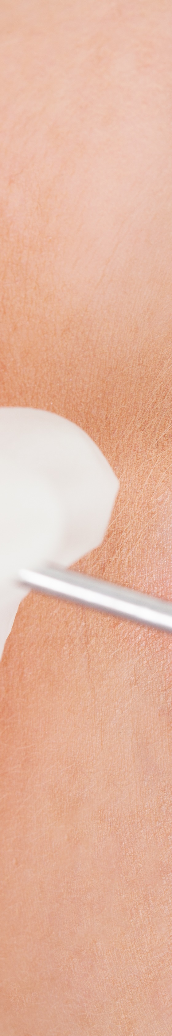 신사동임플란트 건강한 치아로 돌아가는 첫걸음 관련 이미지 25