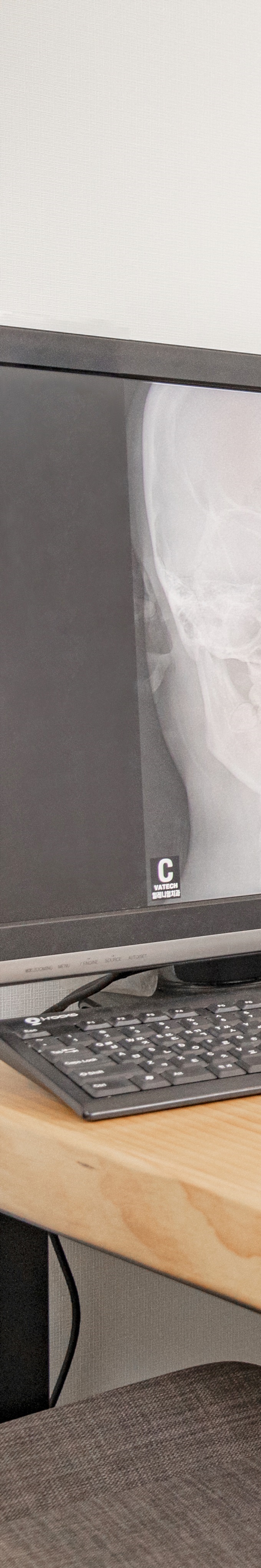 Understand the Side Effects of Maxillary Sinus Lifting Thoroughly and Respond Wisely image 18
