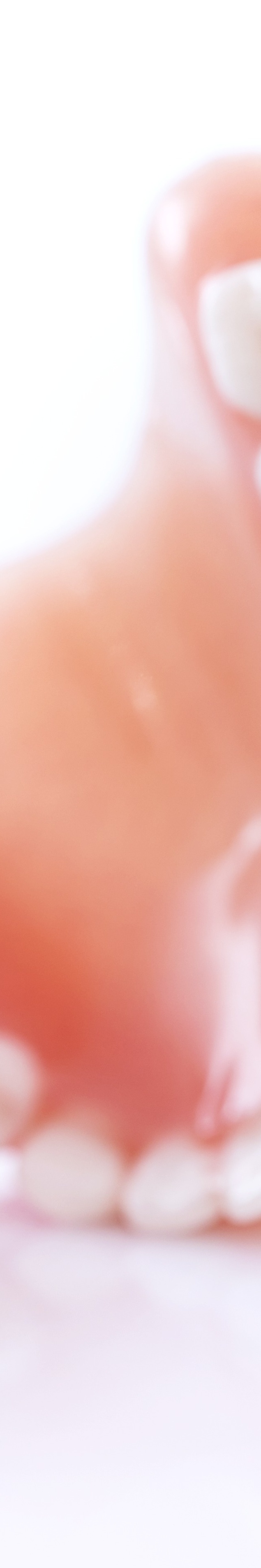 라미네이트 빠짐 이런 경우에 어떻게 해야 할까 관련 이미지 34