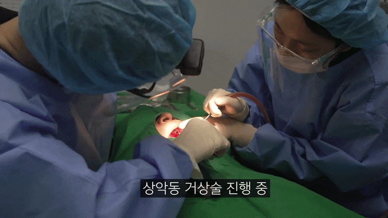 Wondering How Long Full-Arch Implant Surgery Takes? image 7