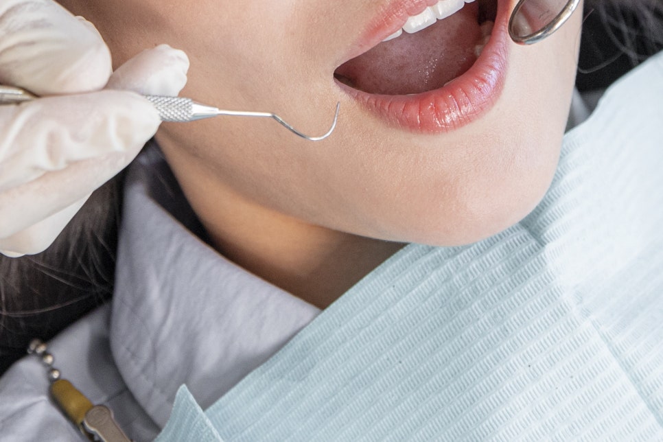 청담동 임플란트 재수술로 이어지지 않게! 관련 이미지 16