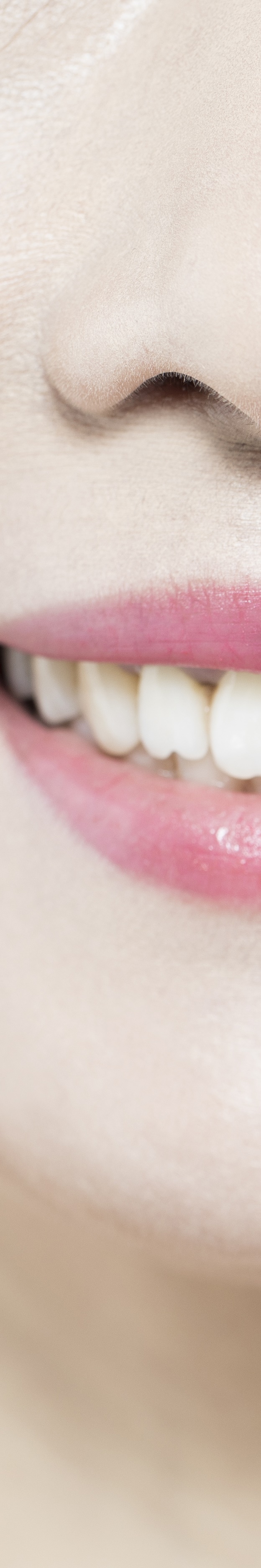 라미네이트 재시술 완벽한 미소를 위한 두 번째 여정 관련 이미지 26