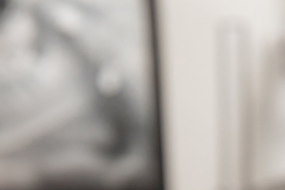 풀아치임플란트 잘하는곳 다수 식립 비용이 부담이라면 관련 이미지 19