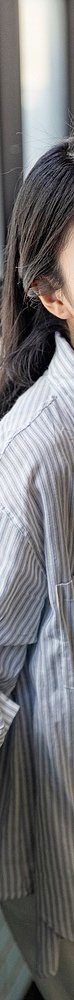 Worried That Apgujeong Veneers Might Be Too White? image 31