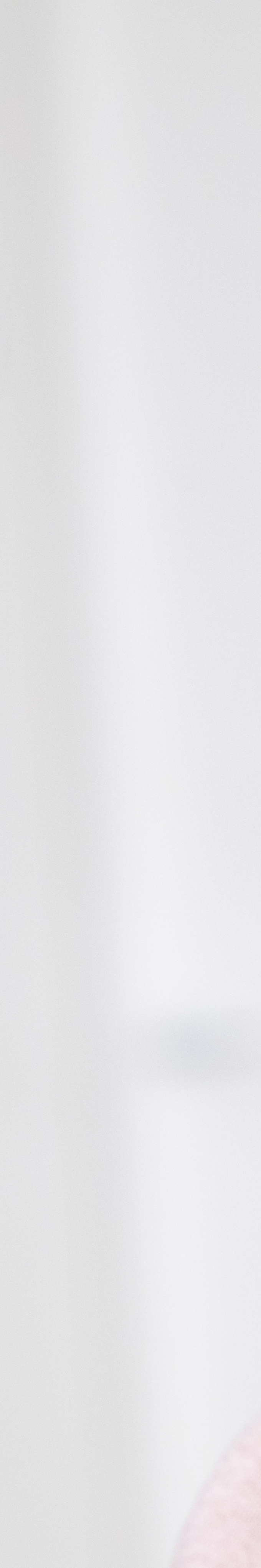 아랫니 라미네이트 숨겨왔던 미소를 되찾는 여정 관련 이미지 24