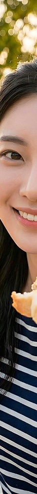 압구정 앞니 라미네이트, 색만 보고 결정하면 나중에 아쉬워지는 이유 관련 이미지 18