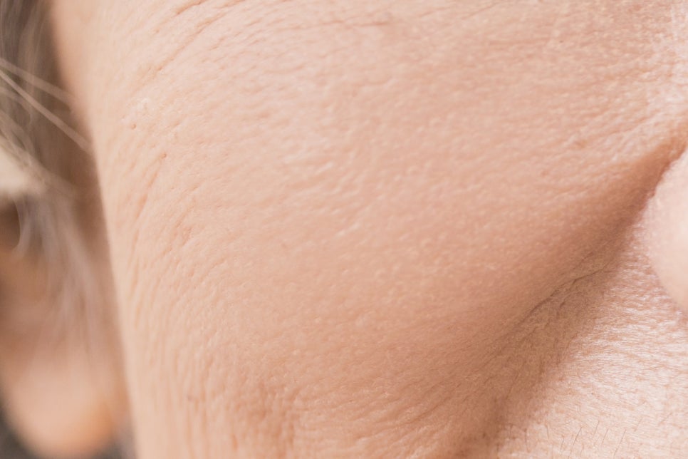 강남 65세이상임플란트 이것만 참고하자! 관련 이미지 9