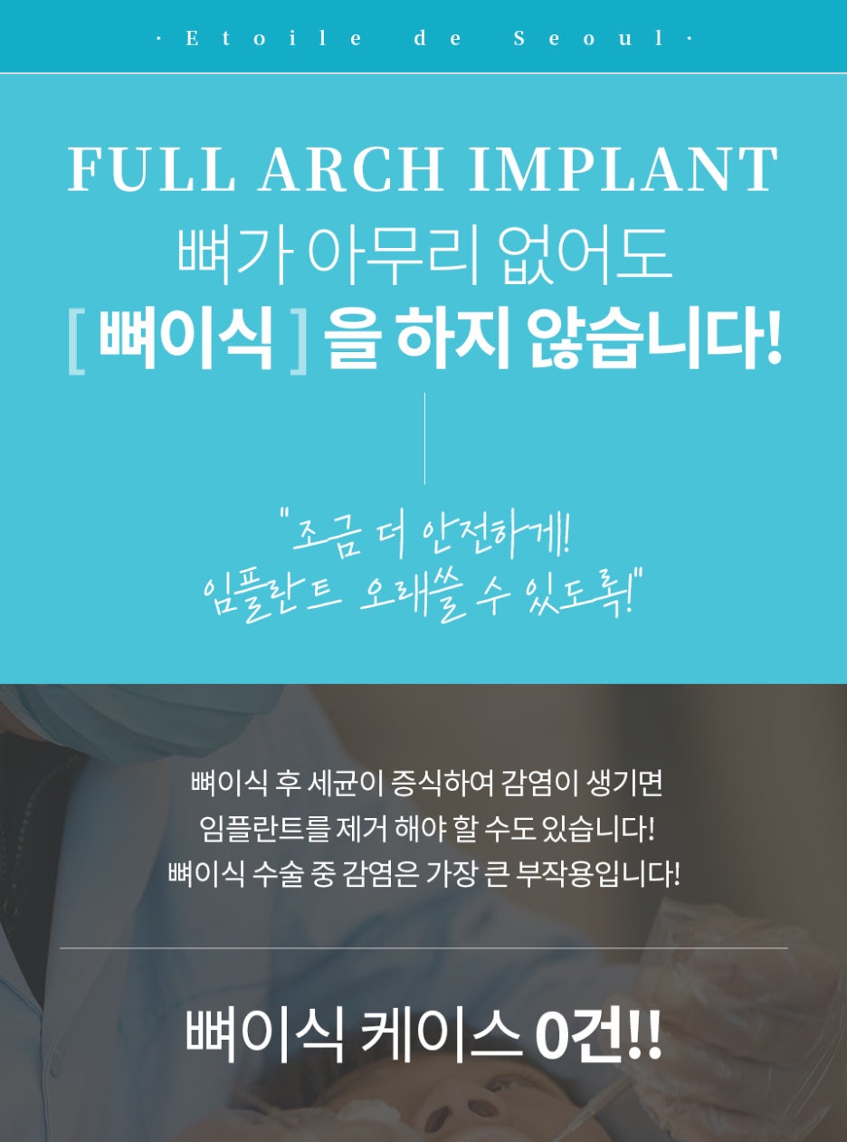 임플란트보험적용나이 기준을 체크하자 관련 이미지 20