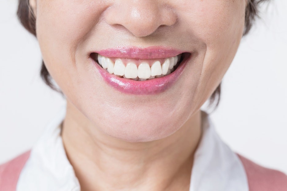 압구정 풀아치 임플란트 비교 기준 관련 이미지 6