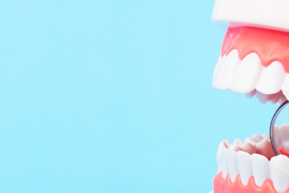 풀아치임플란트 불편한 틀니와 작별해요! 관련 이미지 13