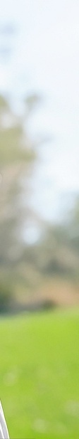 뼈이식 하지 않는 임플란트 상황에 따른 대처방법 관련 이미지 30