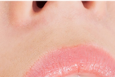 청담동치과 추천 앞니가 부러졌어요! 관련 이미지 11