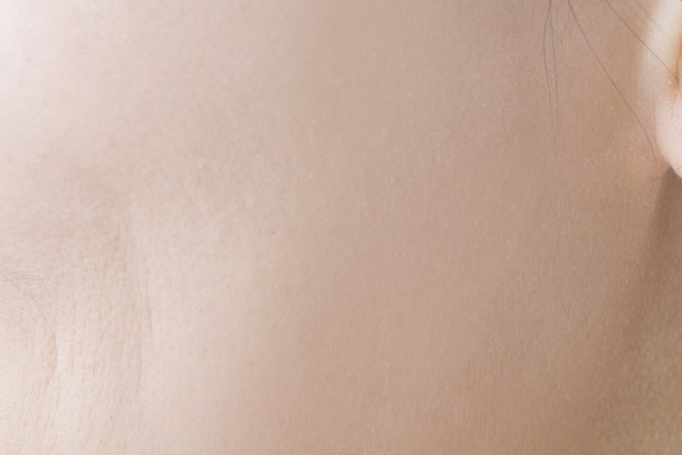 강남 20대임플란트 젊다고 방치는 금지 관련 이미지 23