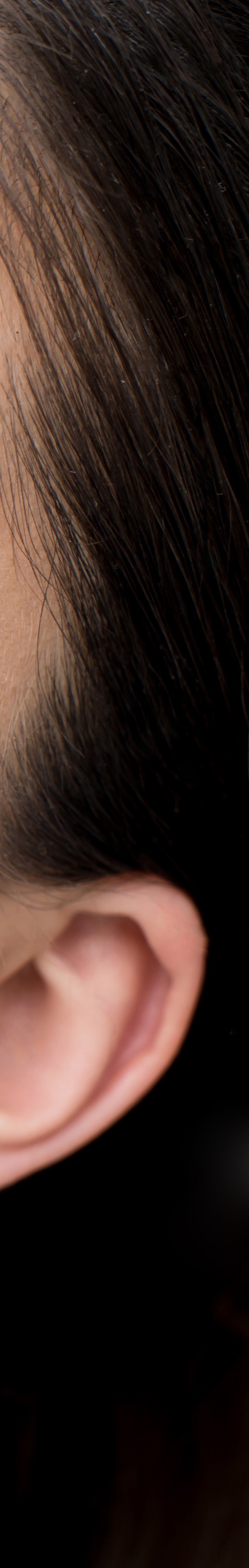 올온엑스 무치악이라도 걱정없이 치료 관련 이미지 34