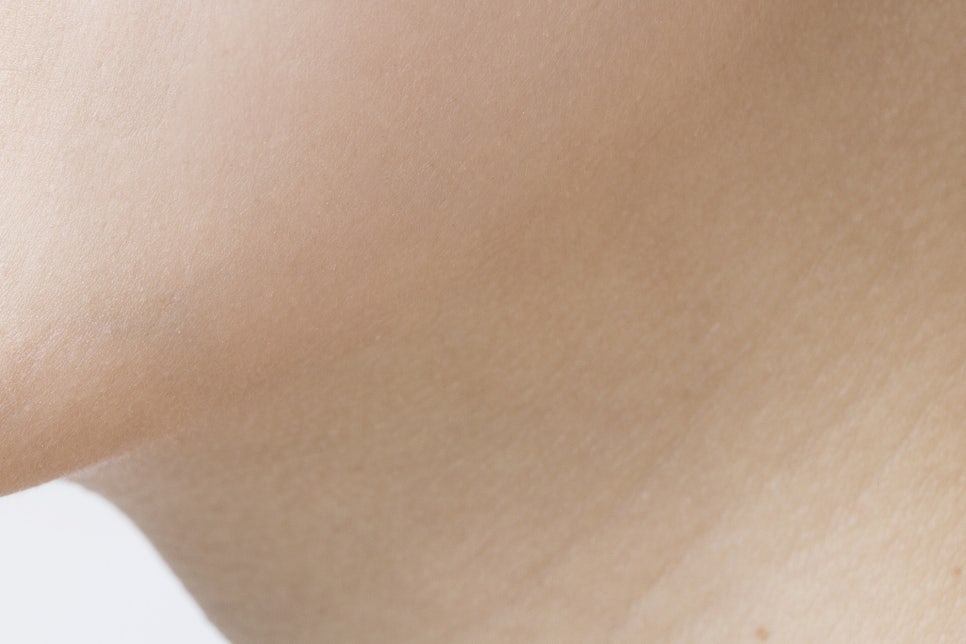 강남 20대임플란트 젊다고 방치는 금지 관련 이미지 26