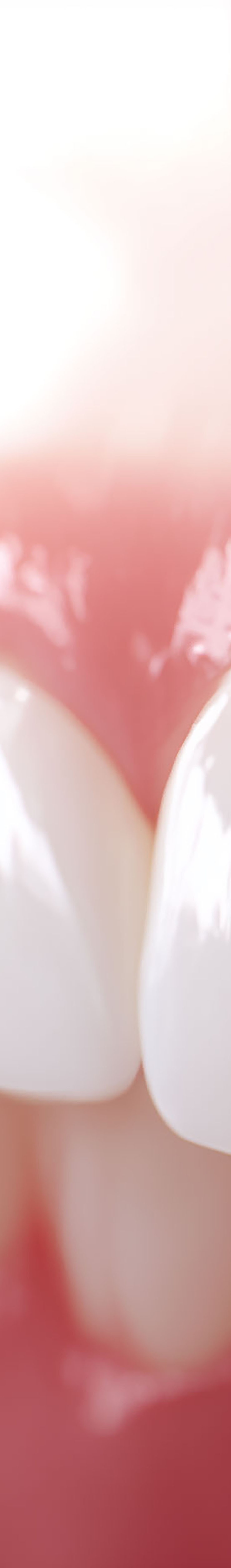 압구정로데오치과 라미네이트 어떤 포인트를 체크해야 할까 관련 이미지 21