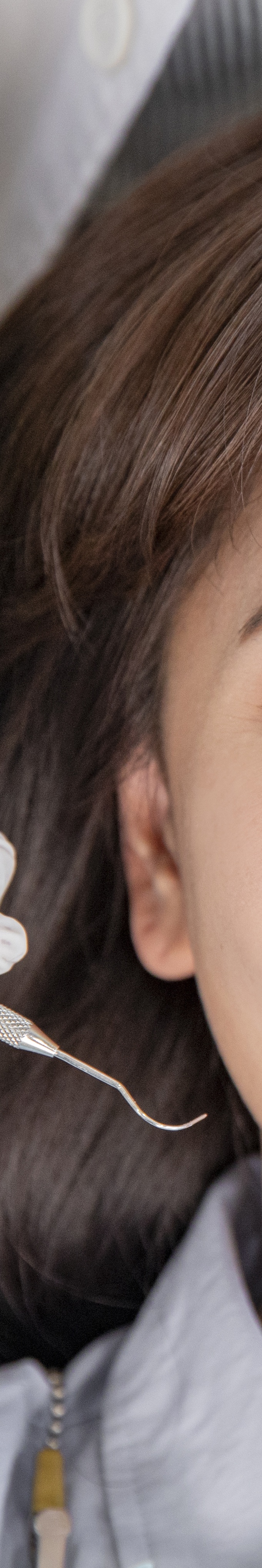 압구정로데오치과 라미네이트 어떤 포인트를 체크해야 할까 관련 이미지 31