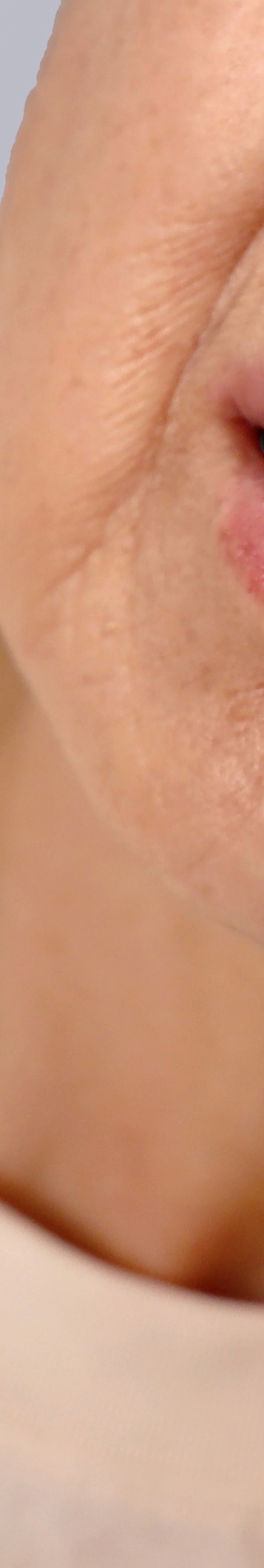 압구정로데오역치과 꼼꼼하게 살펴봐야 관련 이미지 23