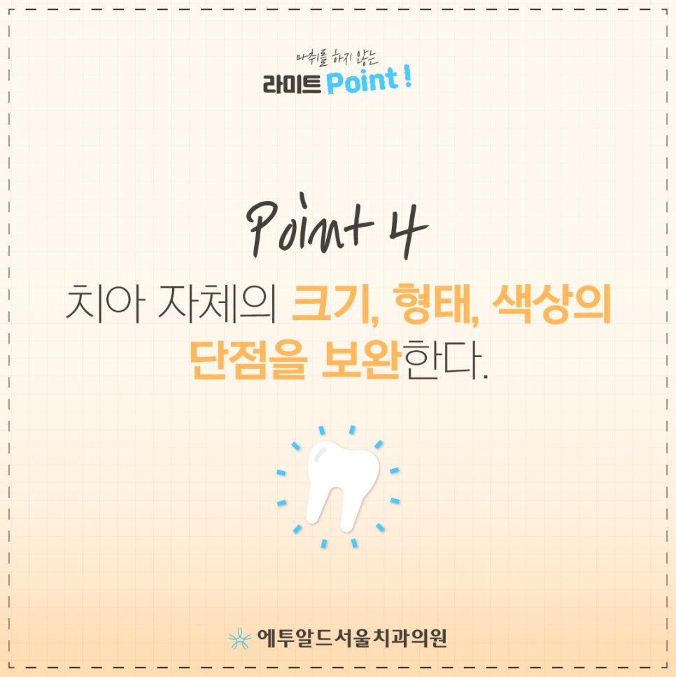 무마취 라미네이트 이거 알았으면 벌써 했지! 관련 이미지 5