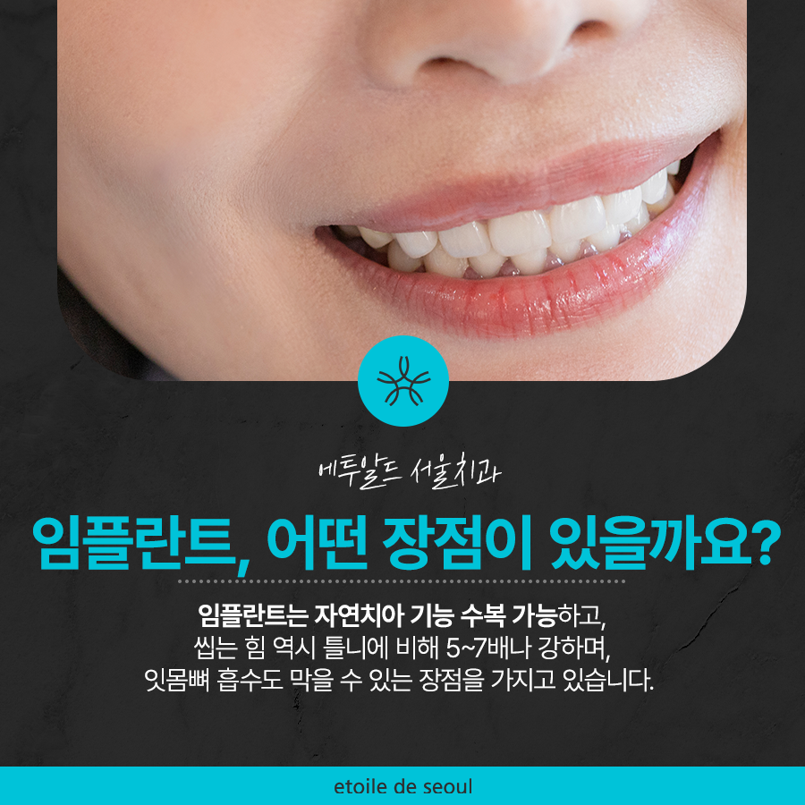 청담 임플란트 치과 미룰수록 독이에요! 관련 이미지 2