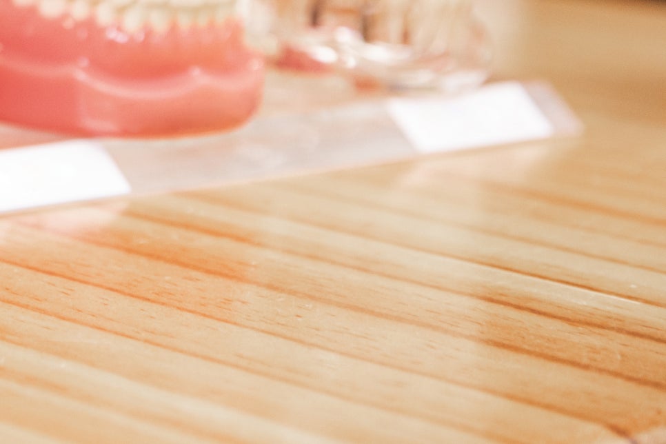 풀아치임플란트 잘하는곳 다수 식립 비용이 부담이라면 관련 이미지 27