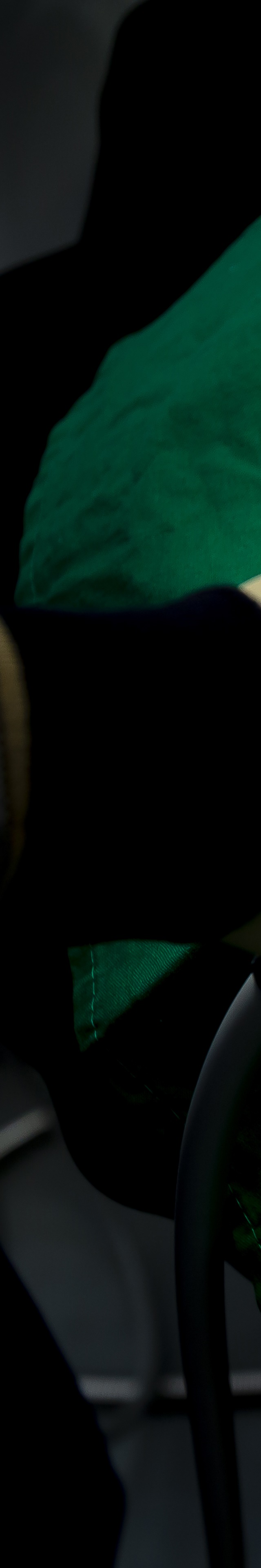 아랫니 라미네이트 숨겨왔던 미소를 되찾는 여정 관련 이미지 15