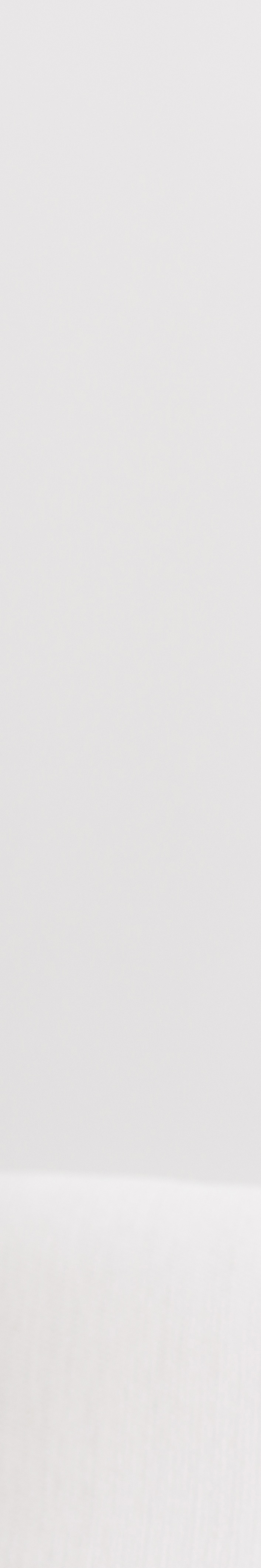 서울무삭제라미네이트 치아 본연의 아름다움을 지키다 관련 이미지 31