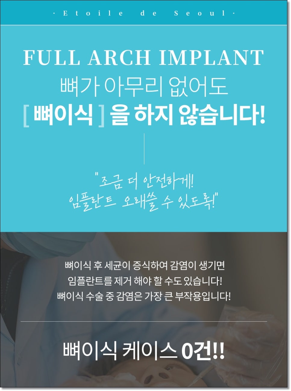 신사동 무삭제 라미네이트 모두 가능한가요? 관련 이미지 10