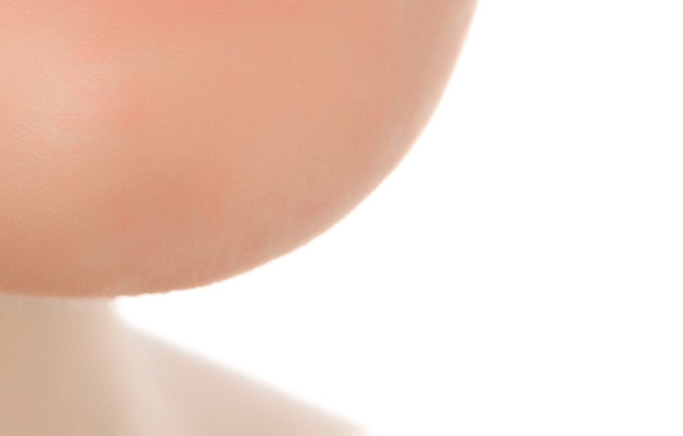 풀아치 임플란트 무치악으로 고생한다면? 관련 이미지 25