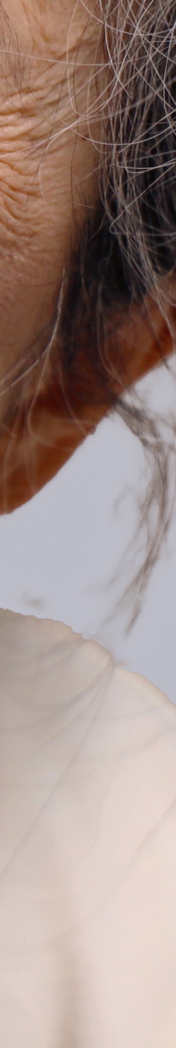 압구정로데오역치과 꼼꼼하게 살펴봐야 관련 이미지 28