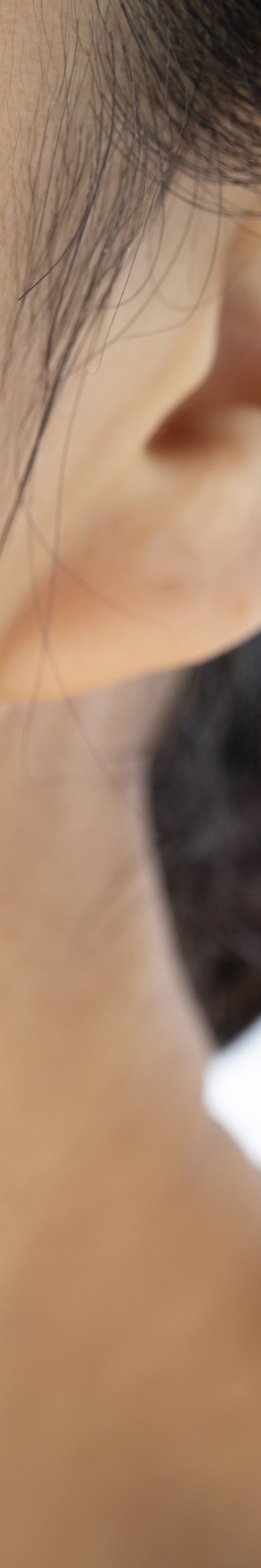 앞니임플란트잘하는곳 당신의 웃음을 찾아드립니다 관련 이미지 30