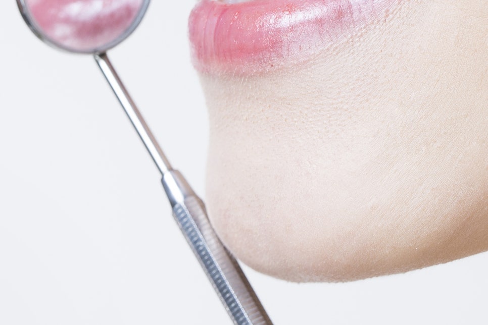 강남 20대임플란트 젊다고 방치는 금지 관련 이미지 25