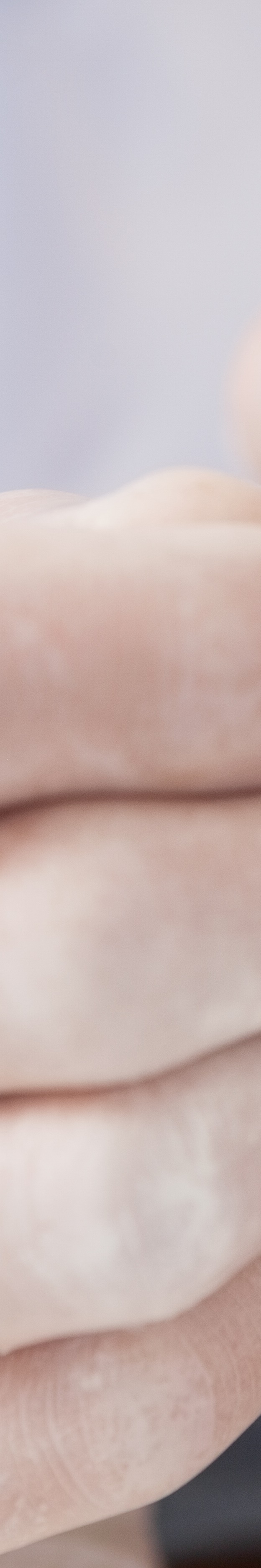 최소 삭제 라미네이트 치아를 지키며 아름다움 더하기 관련 이미지 26