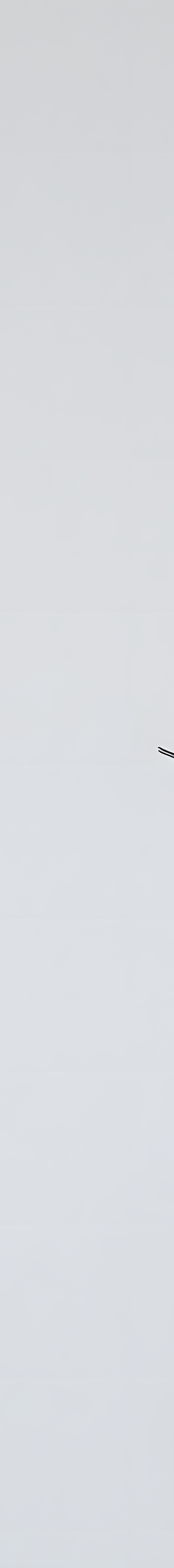 라미네이트 재시술 완벽한 미소를 위한 두 번째 여정 관련 이미지 15