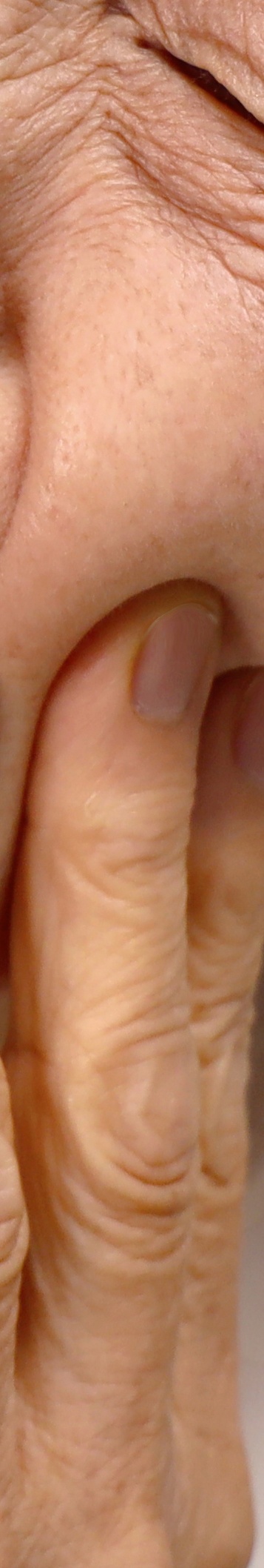 압구정로데오역치과 꼼꼼하게 살펴봐야 관련 이미지 26