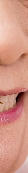 Wondering How Long Full-Arch Implant Surgery Takes? image 40