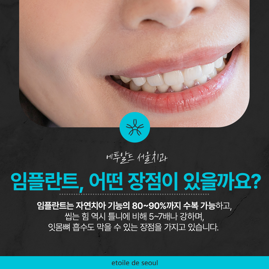 학동사거리 전악임플란트 치과 선택 시 이건 알아두자 관련 이미지 2