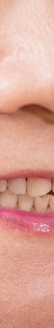 Wondering How Long Full-Arch Implant Surgery Takes? image 39
