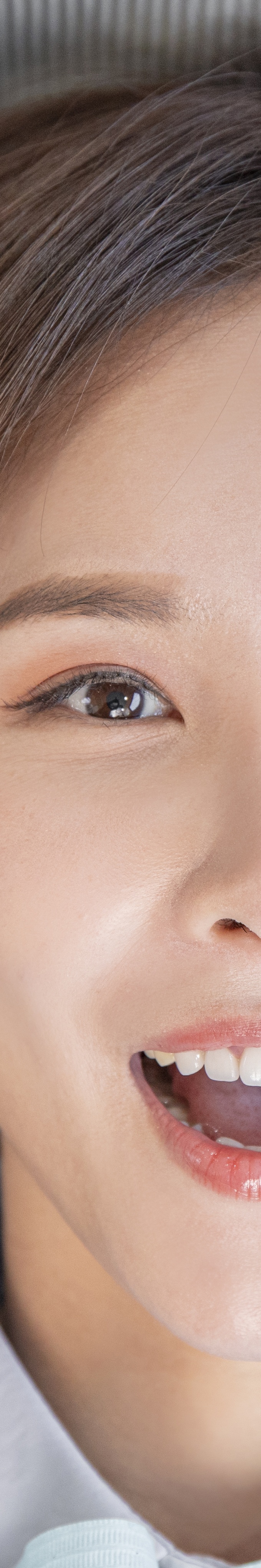 압구정로데오치과 라미네이트 어떤 포인트를 체크해야 할까 관련 이미지 32