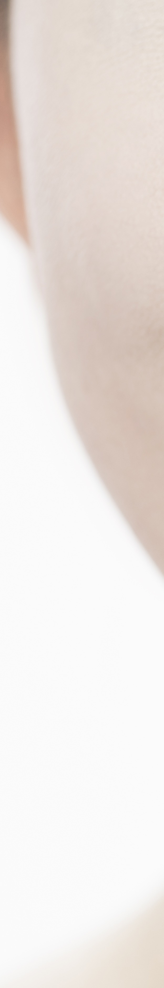 라미네이트 재시술 완벽한 미소를 위한 두 번째 여정 관련 이미지 24