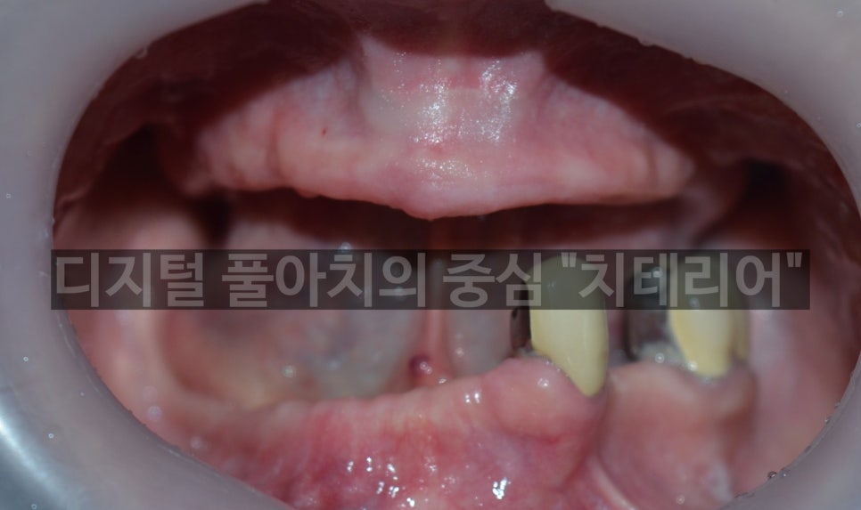 디지털풀아치 하기 전에 꼭 알아야 할 것 관련 이미지 1