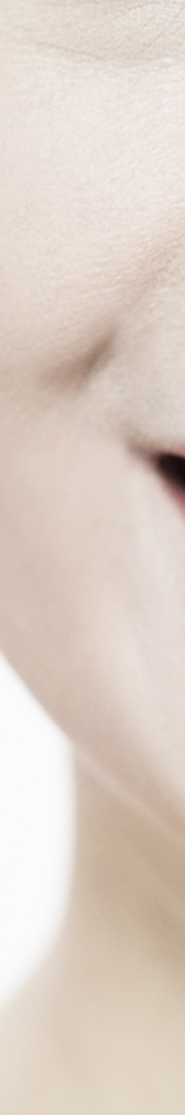 라미네이트 재시술 완벽한 미소를 위한 두 번째 여정 관련 이미지 25