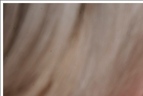 성인 혈압정상수치 범위 벗어나기 관련 이미지 7