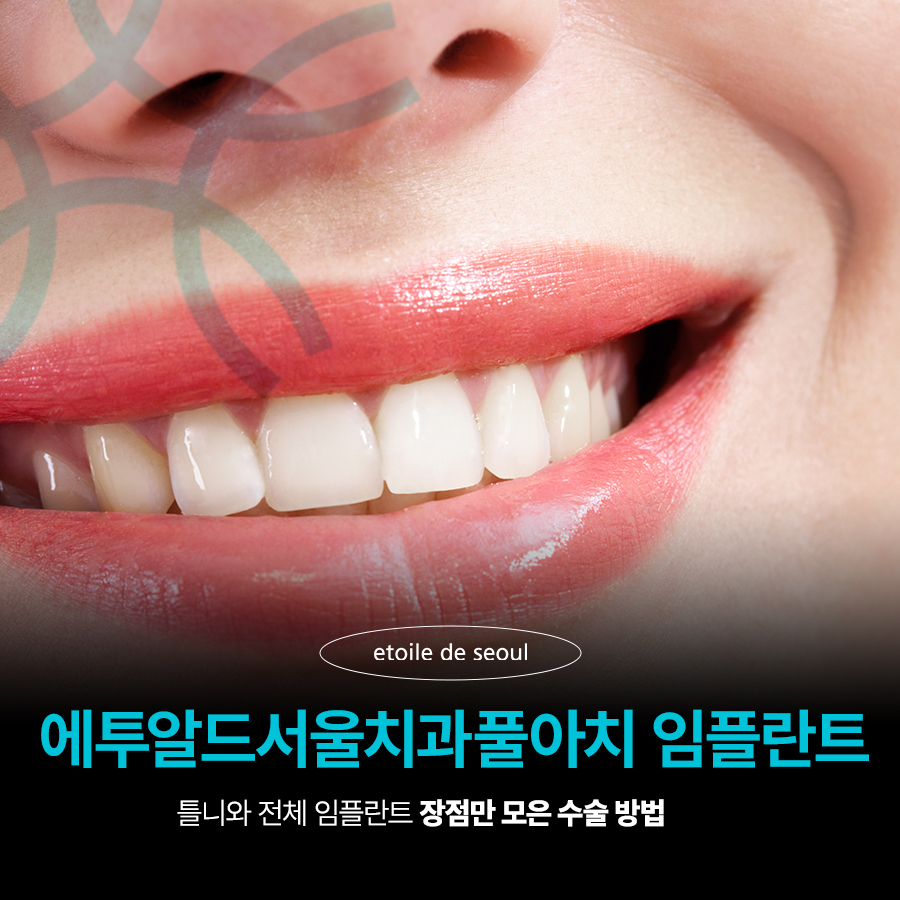 풀아치 임플란트 무치악으로 고생한다면? 관련 이미지 3