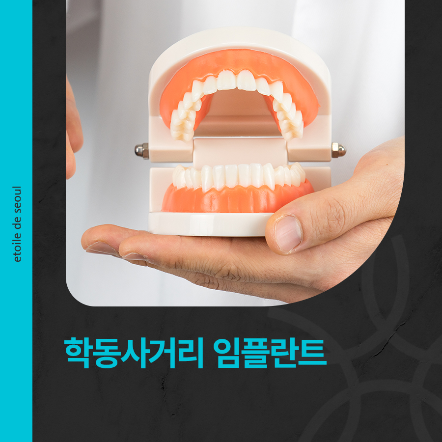 학동사거리 임플란트 심미성을 향상시켜요 관련 이미지 1